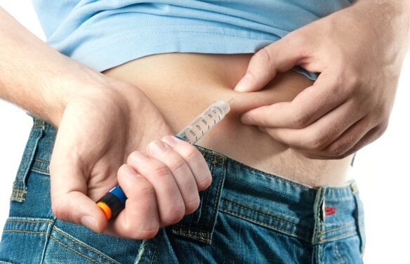 Diabetes jenis 2 yang teruk memerlukan pentadbiran insulin